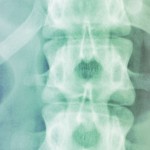 Dynamic X-ray Imaging: A Second Look, a New Diagnosis