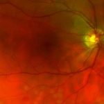 Optical Coherence Tomography: Research that’s Revealing More than Meets the Eye