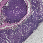 Faster, better, stronger: the power of automated 3D histopathology